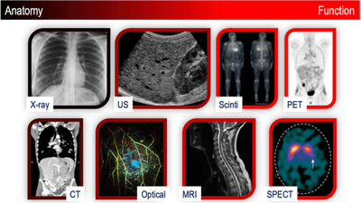 Внесок комп'ютерної томографії в онкологію Внесок комп'ютерної томографії в онкологію