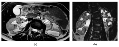 Як КТ допомагає виявити захворювання сечостатевої системи? Як КТ допомагає виявити захворювання сечостатевої системи?