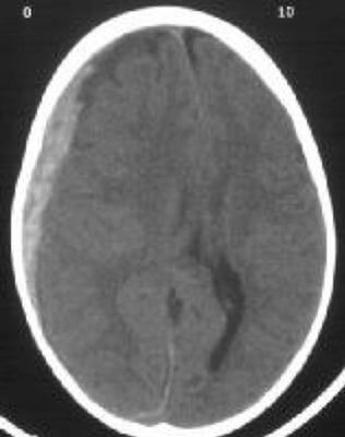 Як правильно інтерпретувати результати КТ і що робити, якщо виявлено відхилення від норми? Як правильно інтерпретувати результати КТ і що робити, якщо виявлено відхилення від норми?