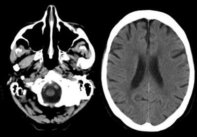 Які існують обмеження та протипоказання для проведення КТ? Які існують обмеження та протипоказання для проведення КТ?